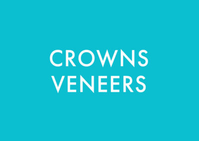Crowns/Veneers